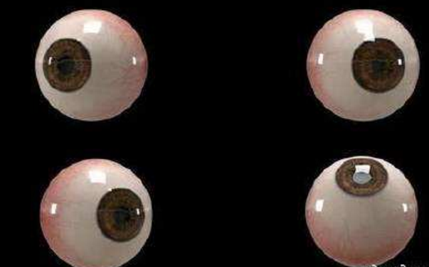 世界首個(gè)3D人工眼球問(wèn)世，數百萬(wàn)人將重見(jiàn)光明
